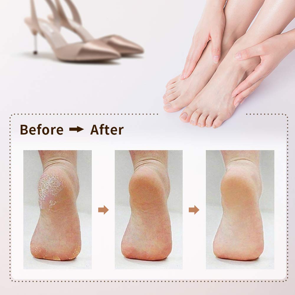 Rechargeable Electronic Feet File Pedicure, Callus Remover - View 7